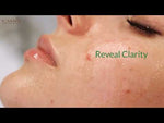 Load and play video in Gallery viewer, Gentle Acne stop treatment - Olive Oil, Tea Tree Soap & Oil