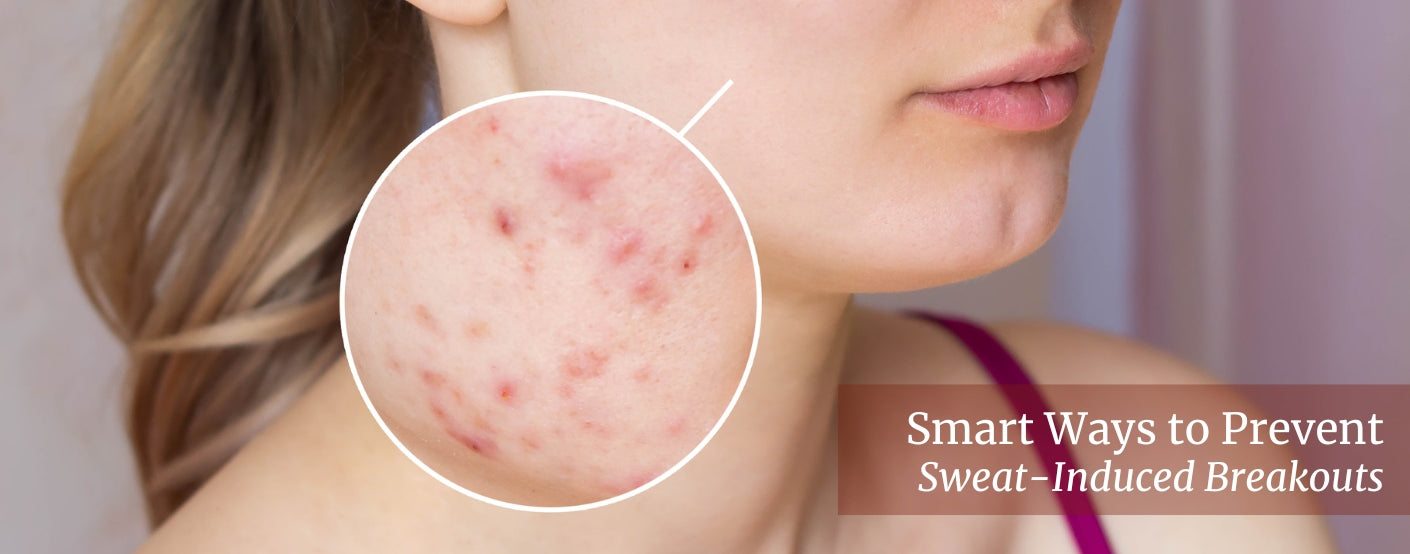 Smart Ways to Prevent Sweat-Induced Breakouts