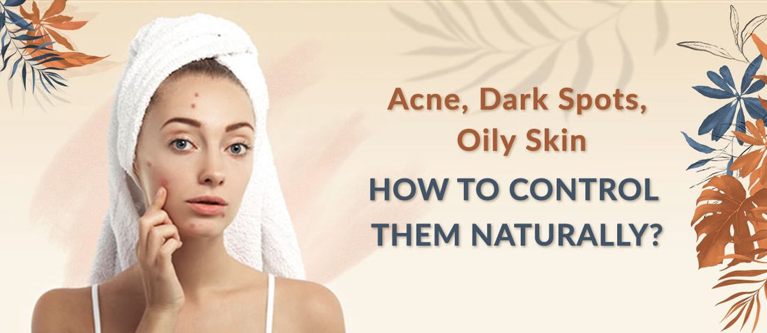 HOW TO CONTROL ACNE NATURALLY