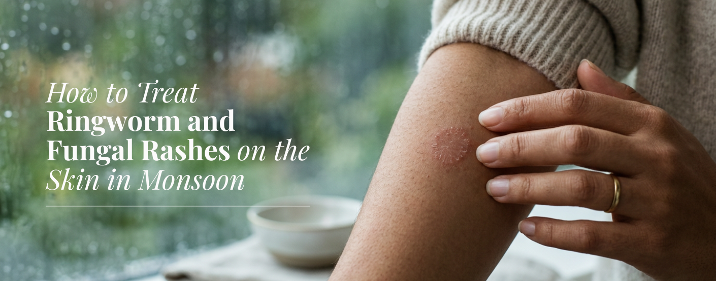 How to Treat Ringworm and Fungal Rashes on the Skin in Monsoon