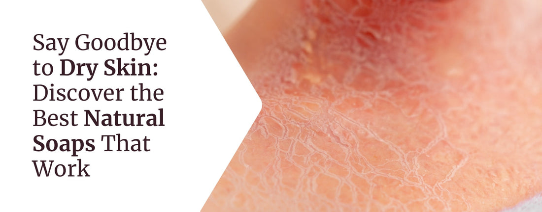 Say_goodbye_to dry_skin