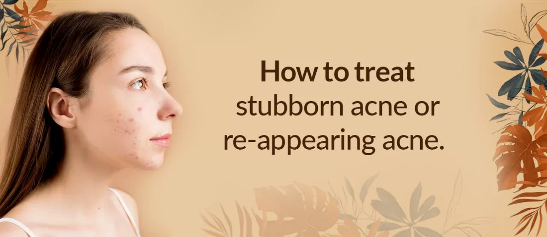 HOW TO TREAT STUBBORN ACNE OR RE-APPEARING ACNE